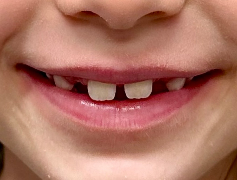Before